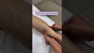 Técnica Rápida Para Aliviar Pernas Pesadas E Cansadas.