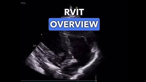 Right Ventricular Inflow Tract (RVIT) View - Echocardiography Education