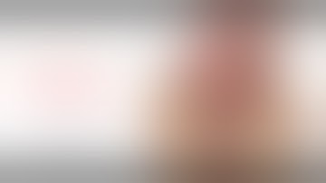 Laparoscopic low anterior resection for rectal cancer- Mr Suhail Anwar