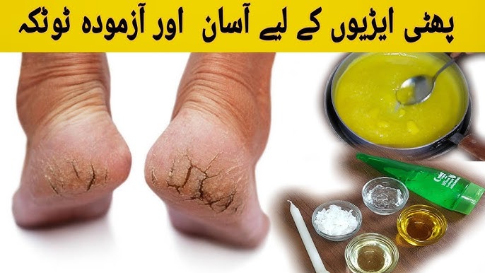 Rus transseksual porno