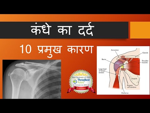 Shoulder Pain in Hindi कंधे का दर्द 10 प्रमुख कारण. Everything about Shoulder pain :Frozen Shoulder