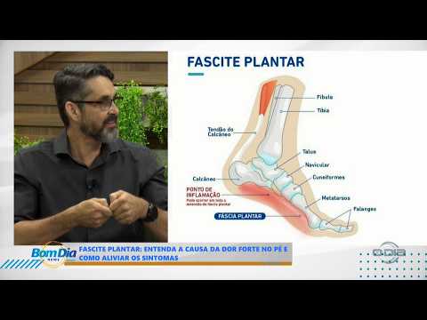 Fascite plantar; Entenda a causa da dor forte no pé e como aliviar os sintomas 03 03 2026