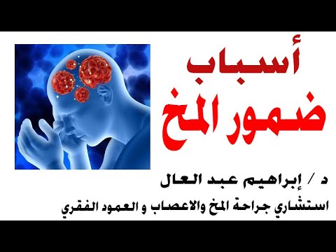 اسباب ضمور المخ حلقة مع  د / إبراهــيم عـبد الـعال  إستشاري جراحة المخ و الأعصاب والعمود الفقري