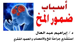 اسباب ضمور المخ حلقة مع  د / إبراهــيم عـبد الـعال  إستشاري جراحة المخ و الأعصاب والعمود الفقري