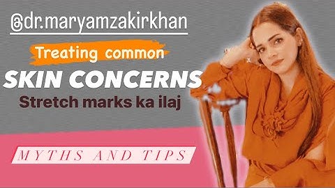 How to remove stretch marks at home easily | palmer’s cocoa butter @Maryamwarsii