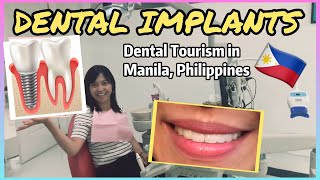 DENTAL IMPLANTS COST PROCEDURE  BEFORE AND AFTER | MANILA PHILIPPINES | DENTAL TOURISM [English Sub]