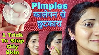 How To Control Oily Skin - Removed Dark Spots & Hyper pigmentation | Get Rid of Oily Skin #oilyface