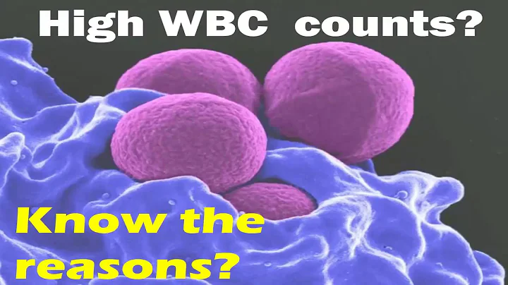HIGH WBC COUNT | Reasons of high white blood cell count | WBC count normal range | High WBC level