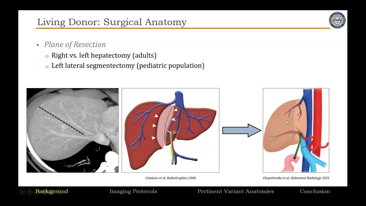 liver transplant case study assignment