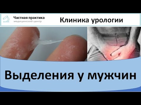 Видео: Выделение мужчины не из ЗППП: ИМП и другие возможные причины