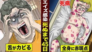 【死病】エイズ感染…死ぬまで45日間。舌にカビが生え…赤斑点まみれになる。