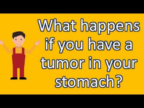 what-happens-if-you-have-a-tumor-in-your-stomach-?-|healthy-living-faqs