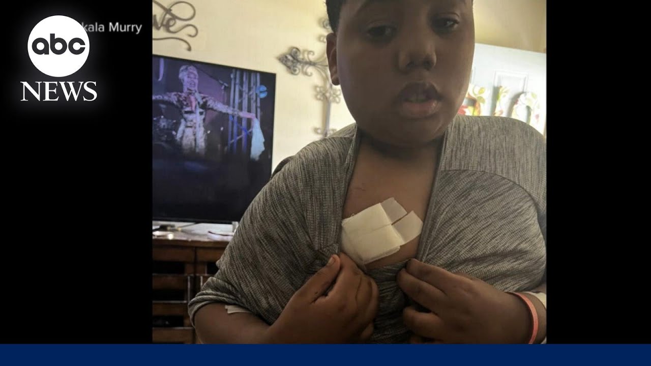 ⁣Family demands answers after 11-year-old shot by police