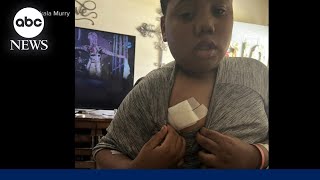 Family demands answers after 11-year-old shot by police