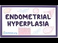 Endometrial hyperplasia - an Osmosis Preview