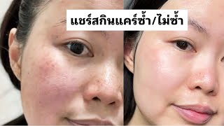 แชร์สกินแคร์ ซ้ำ/ไม่ซ้ำ ฉบับคนมีปัญหา กระ จุดด่างดำ ผิวแห้ง | พลอยกาญ