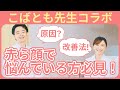 【こばとも先生コラボ】赤ら顔で悩んでる方必見!酒さの症状・原因・改善法を完全解説!