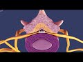 MILD procedure of lumber spinal stenosis (3D animation) Mp3 Song
