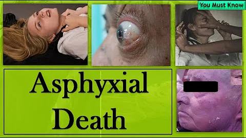 Asphyxia and its Causes | Asphyxial Death | Forensic Medicine | You Must Know Official