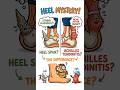 Heel Pain? It’s NOT Always What You Think! 👣 #physiotherapy #physicaltherapy #physio#heelpain #pain