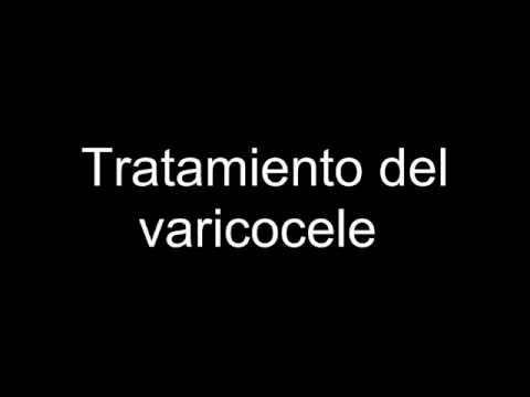 Video: Técnicas disponibles para el tratamiento del varicocele