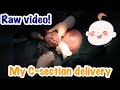 Raw Video of My Baby Coming Out of My Tummy | Marjorie May Yap