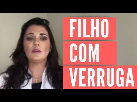 Vídeo: Como Tratar Verrugas Em Crianças