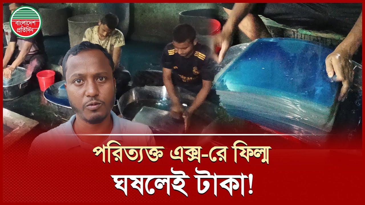 ফেলে দেওয়া এক্স-রে ফিল্মে কর্মসংস্থান, নতুন স্বপ্ন দেখাচ্ছে কুমিল্লার তরুণরা | X-Ray Film Business