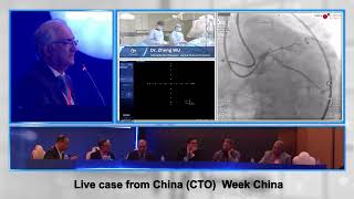 Live Case from China CTO