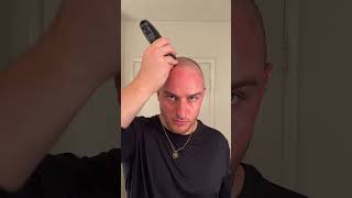 The come back #buzzcut #hair #hairtransformation #shave #toupee #wig #bald