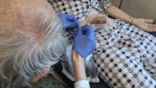 Changing Ostomy Bag Part 2