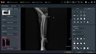 LG AWS VET - How to use TPLO