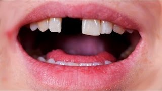 12 YEAR OLD KID GETS HIS TEETH KNOCKED OUT. RESPONSE.
