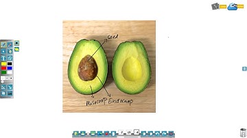 Auto grouping feature in Intellispace - EyeRIS IX