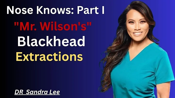 “The Nose Knows: Part I – ‘Mr. Wilson’s’ Blackhead Extractions” DR SANDRA LEE