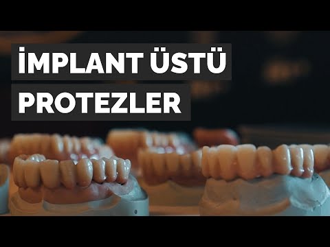 Video: Abutment klipsleri nedir?