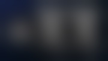 V2 Vertebral Artery Dissection and Transposition with Decompression of the C5 Cervical Nerve Root