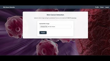 Skin Cancer Detection Using Deep Learning