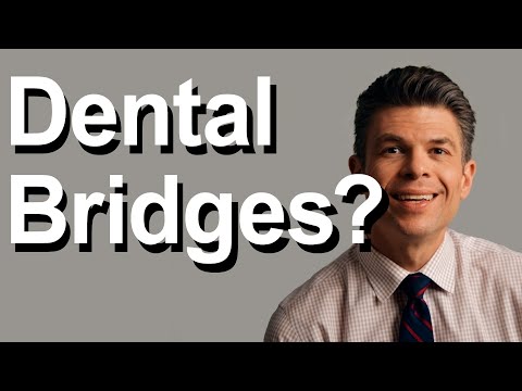 Do you need a dental bridge?