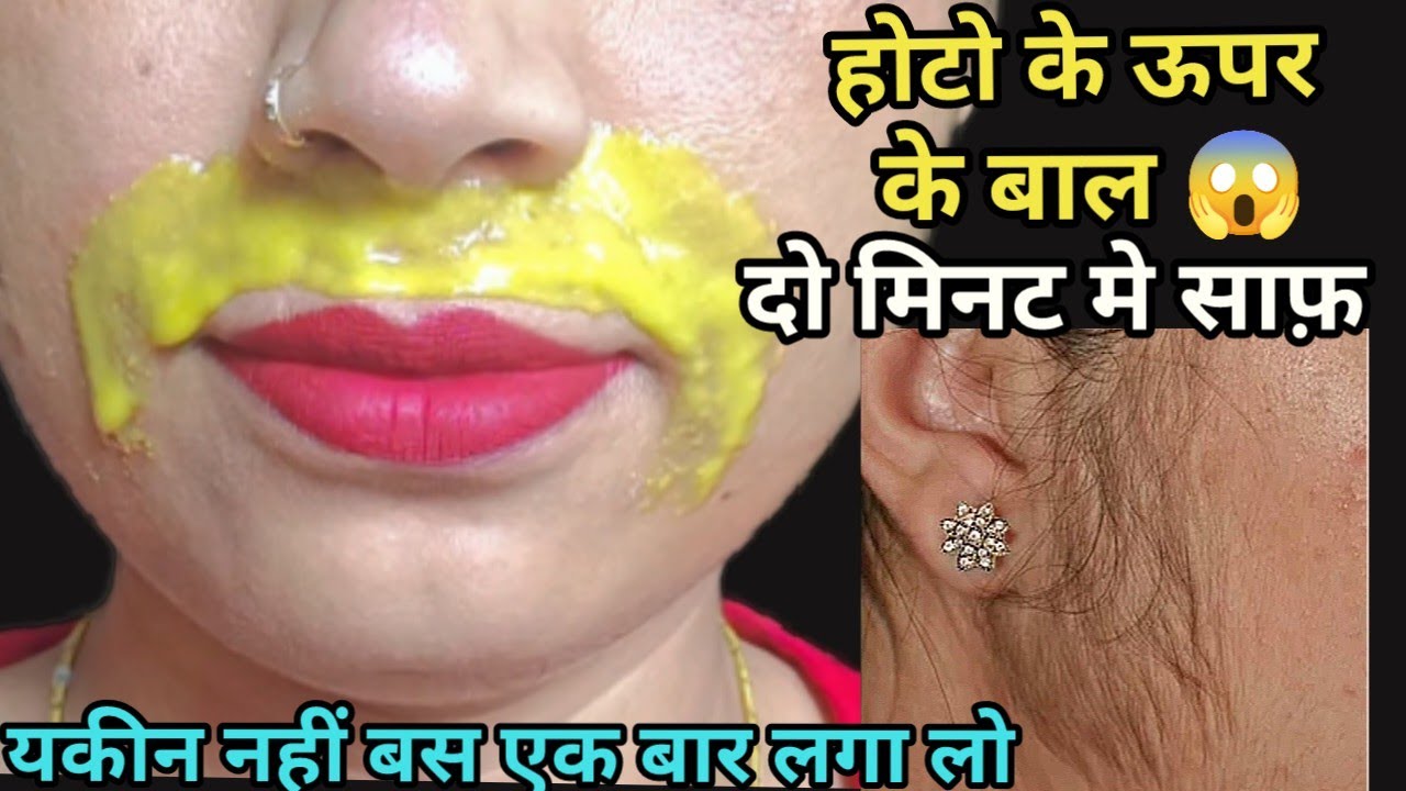 पहली बार में ही facial hair ऐसे हटेगा🤔की महीनो तक बाल नहीं😱 unwanted
