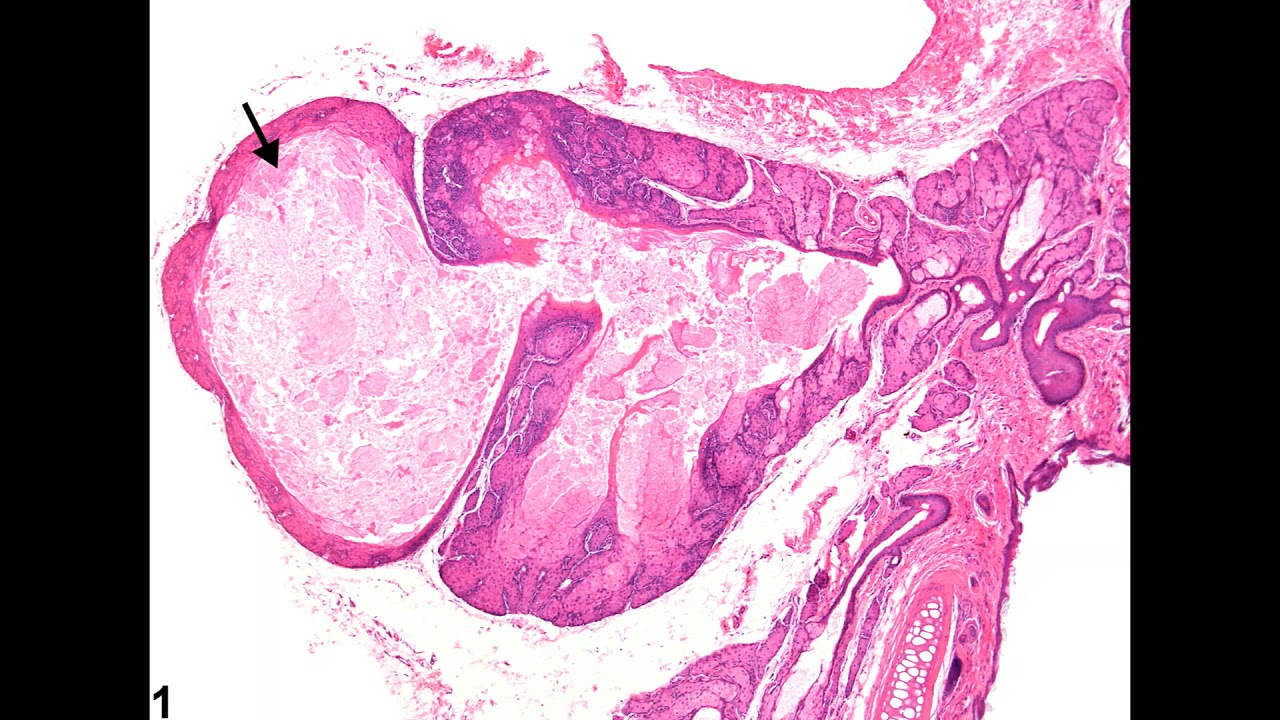 53 Hz : Glandular Tissue (RIFE Healing Frequency)