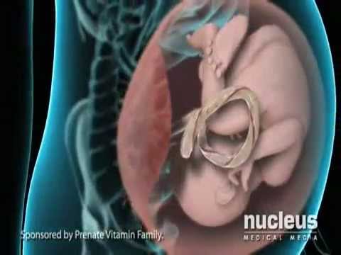 Amniocentesis (el test del fluido amniotico)