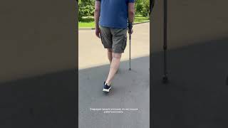 История пациента после эндопротезирования тазобедренного сустава