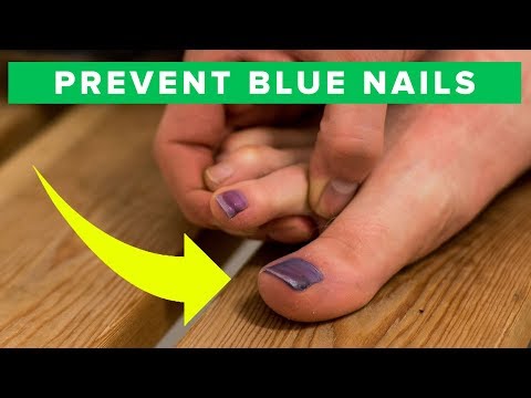 How to prevent blue toe nails - learn how to avoid black nails