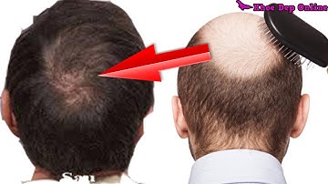 7 Cách Làm Tóc Mọc Nhanh Dài và Dày Trong 7 Ngày