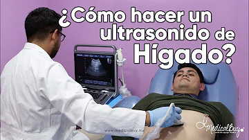 ¿Puede una ecografía indicar si el hígado está inflamado?