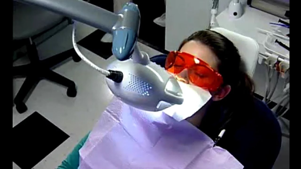 How Power Whitening Works