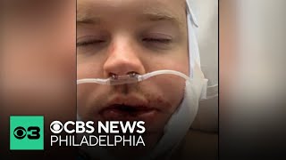 Suspect wanted after random attack leaves victim badly injured: "It was a totally vicious attack."