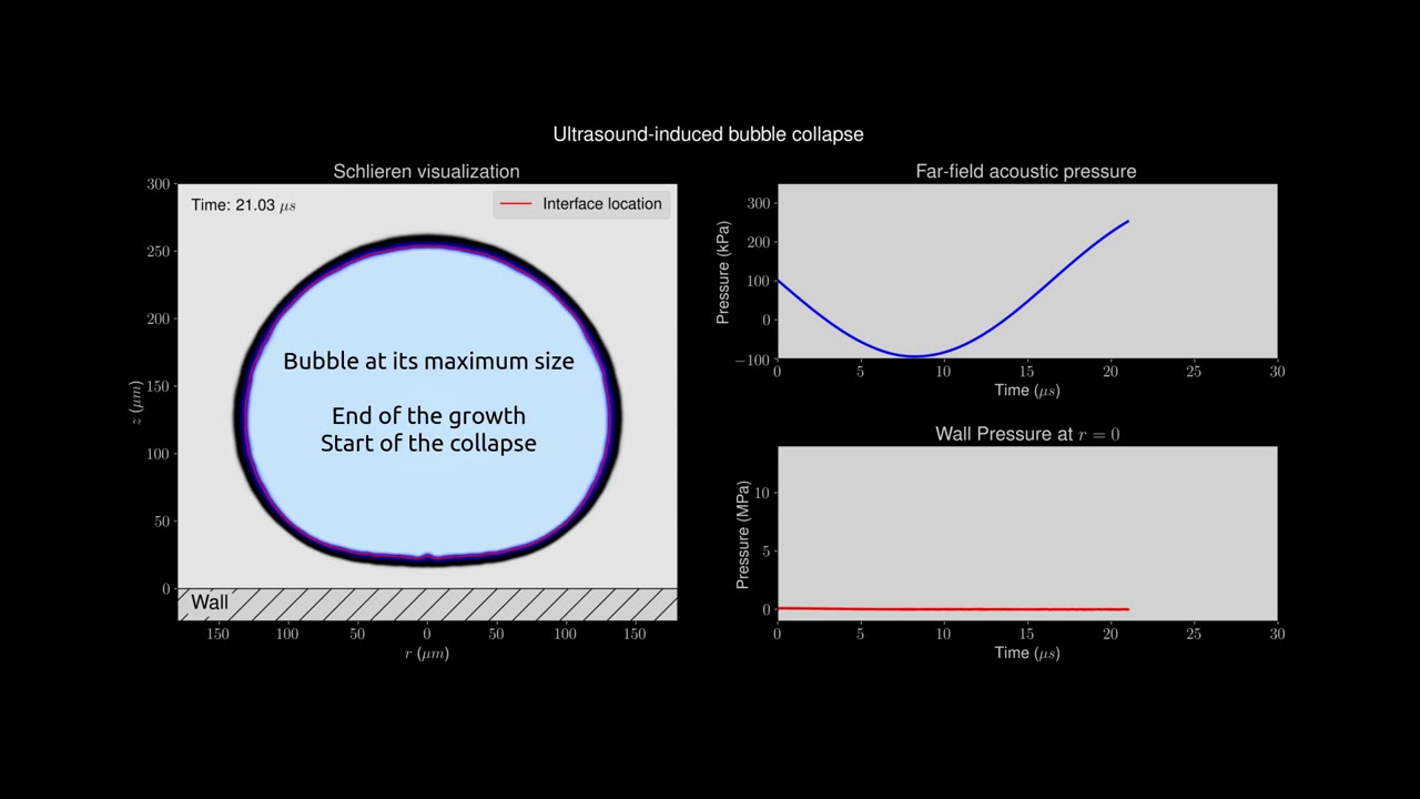 Simulation of the ultrasound-induced growth and collapse of a near-wall ...