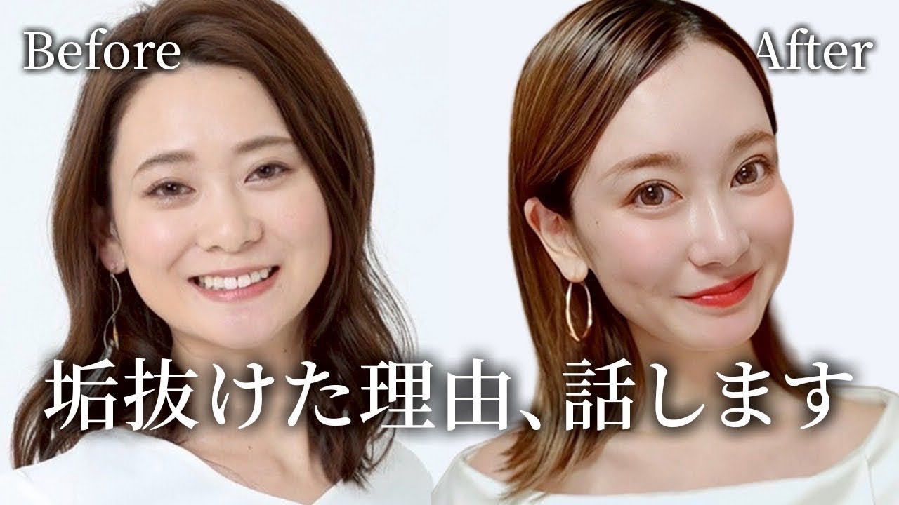 【36歳/垢抜け迷子】6年前より今の方が若く見える！垢抜けたいのに変われなかった私が、10年かけて見つけた“答え”